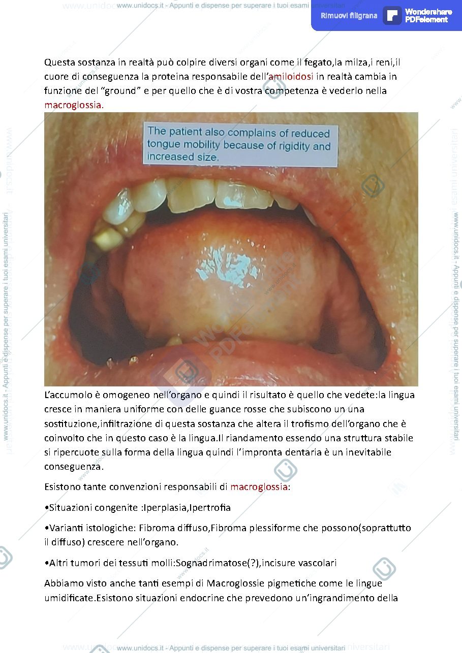 Anteprima pagina 2 — AMILOIDOSI