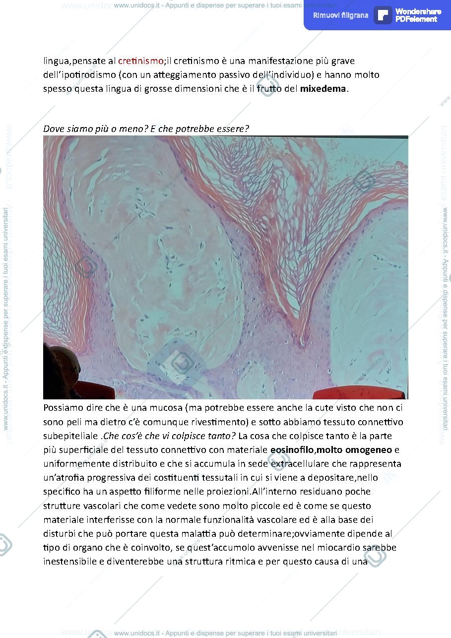 Anteprima pagina 3 — AMILOIDOSI
