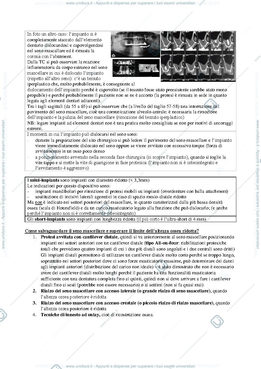Anteprima pagina 2 — Safe implantologyy