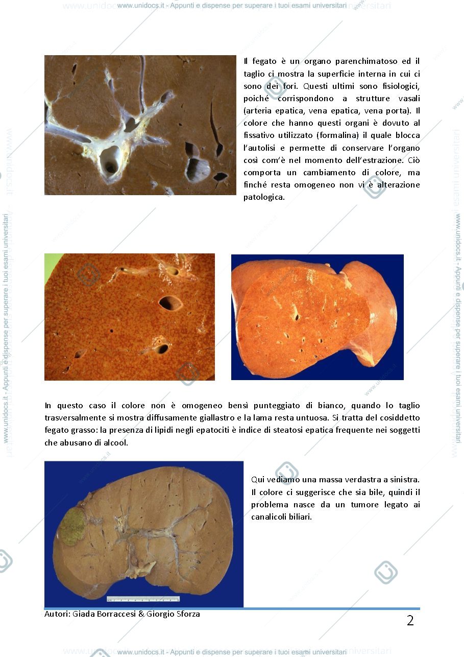 Anteprima pagina 2 — Anatomia patologica 