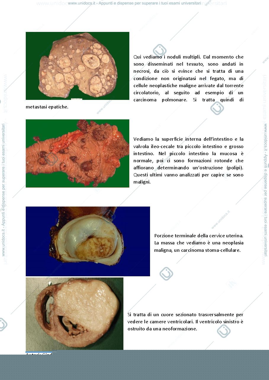 Anteprima pagina 3 — Anatomia patologica 