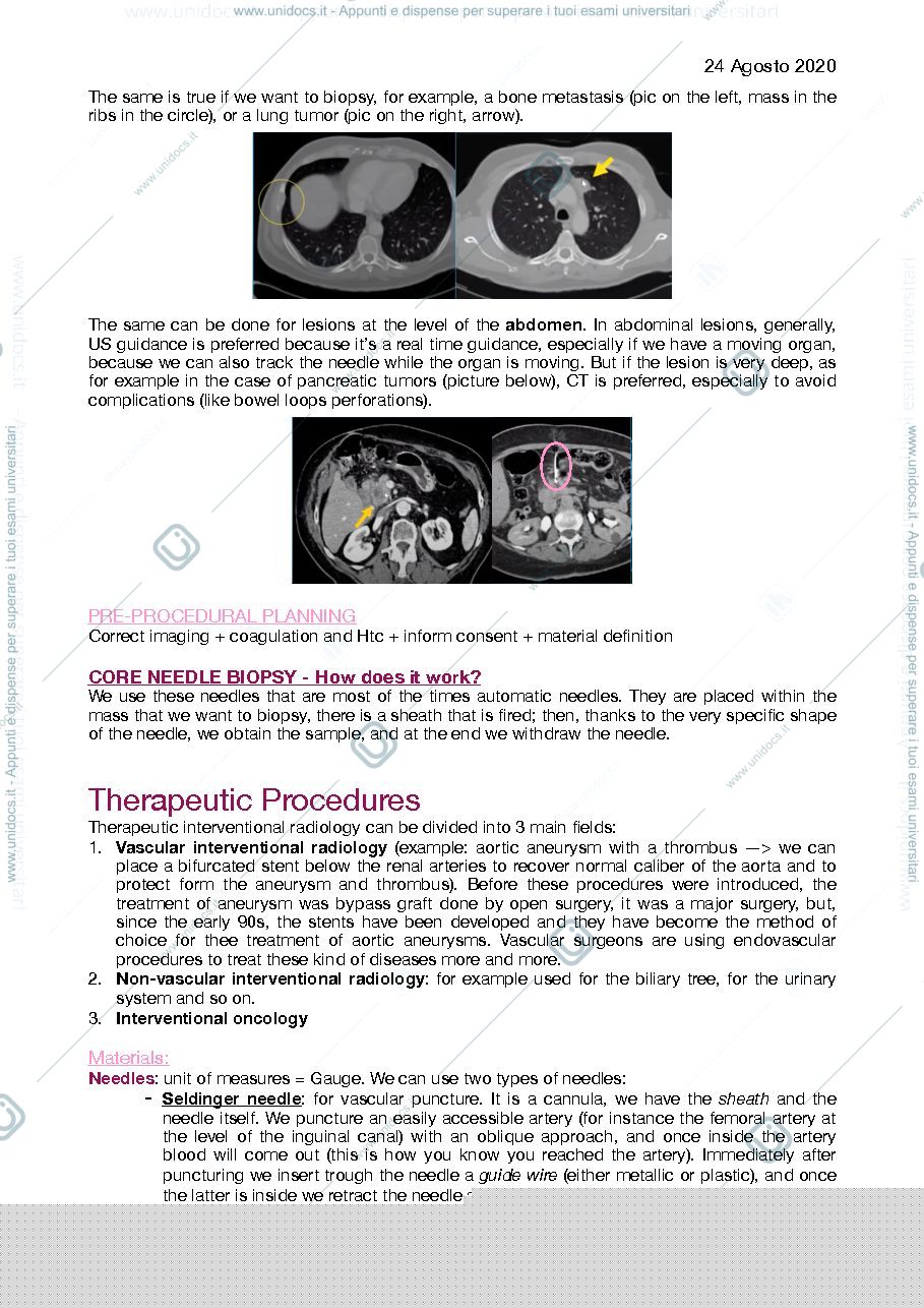 Anteprima pagina 2 — interventional radiology