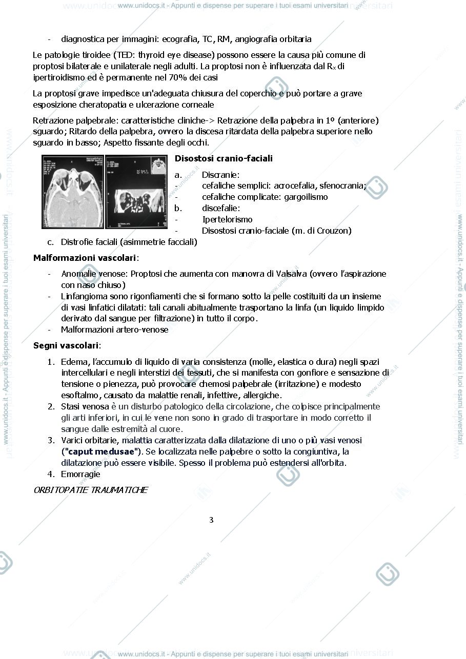 Anteprima pagina 3 — Fisiopatologia del segmento anteriore