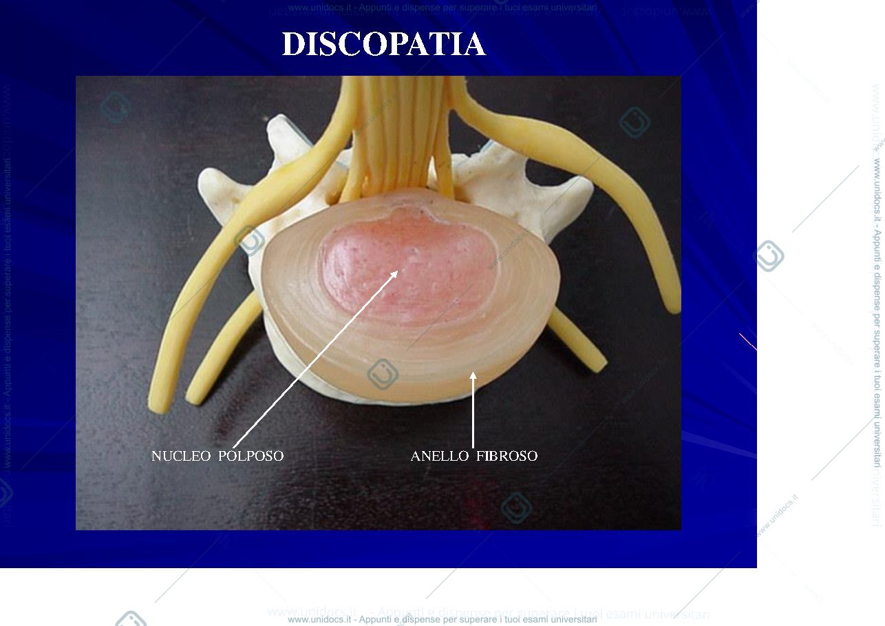 Anteprima pagina 3 — Ernie del disco