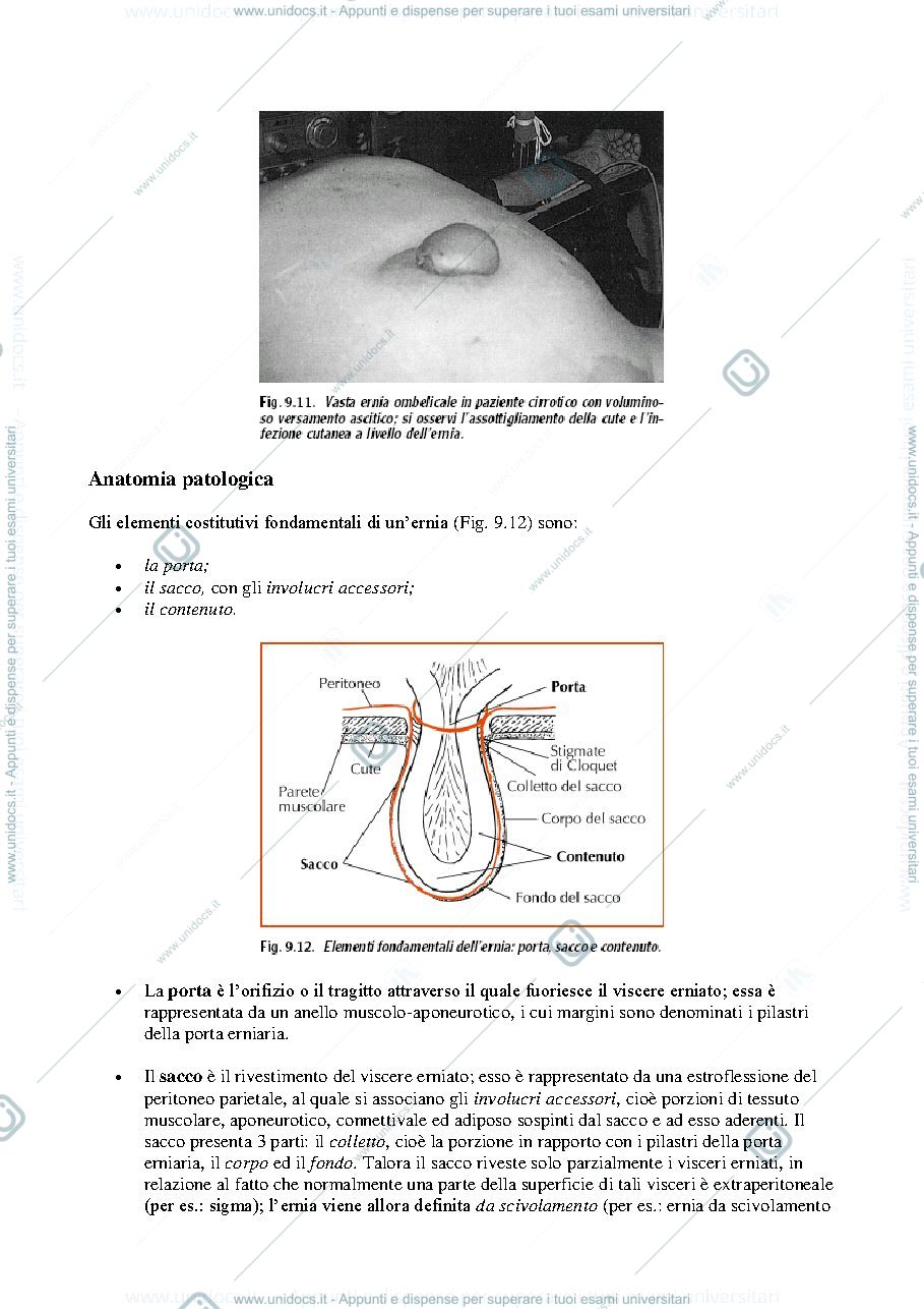 Anteprima pagina 3 — Ernie
