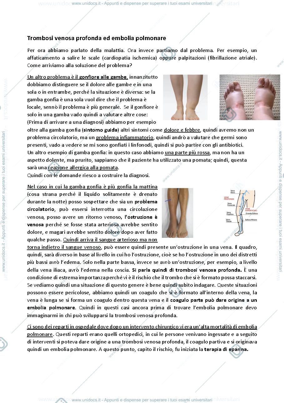 Anteprima pagina 1 — Trombosi venosa