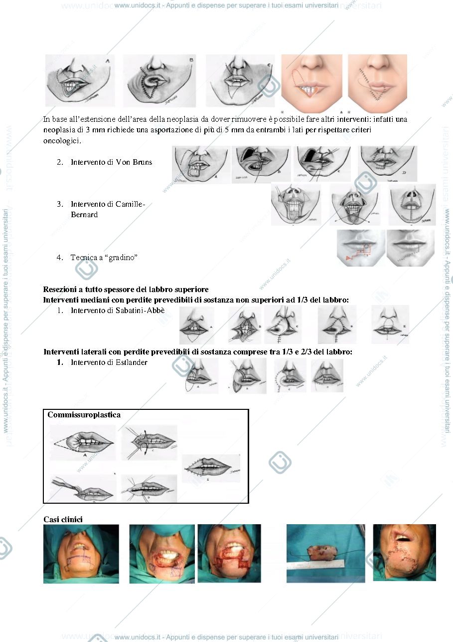 Anteprima pagina 2 — Stazioni linfonodali