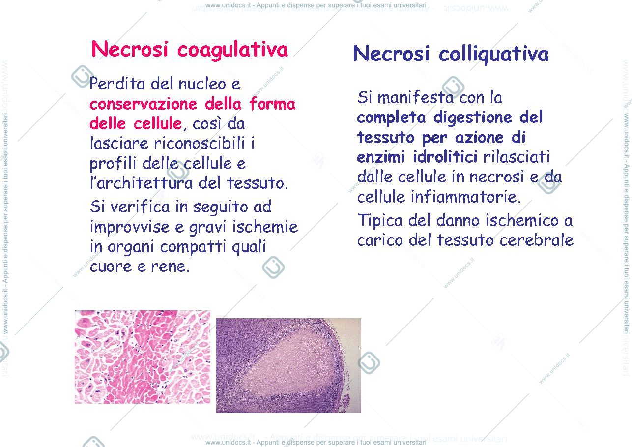 Anteprima pagina 4 — ischemia 