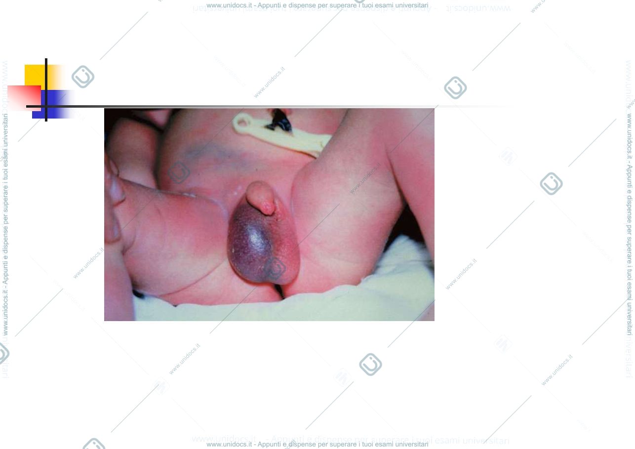Anteprima pagina 4 — SCROTO ACUTO