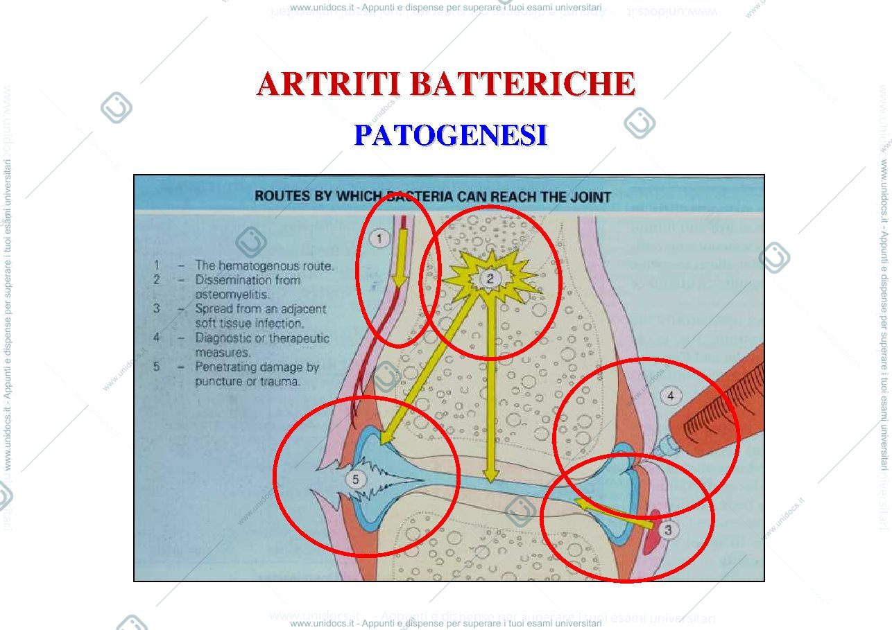 Anteprima pagina 3 — artriti infettive