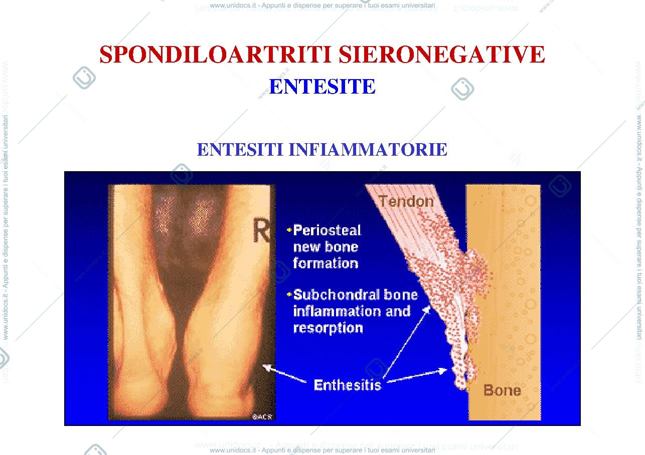 Anteprima pagina 2 — artrite reumatoide