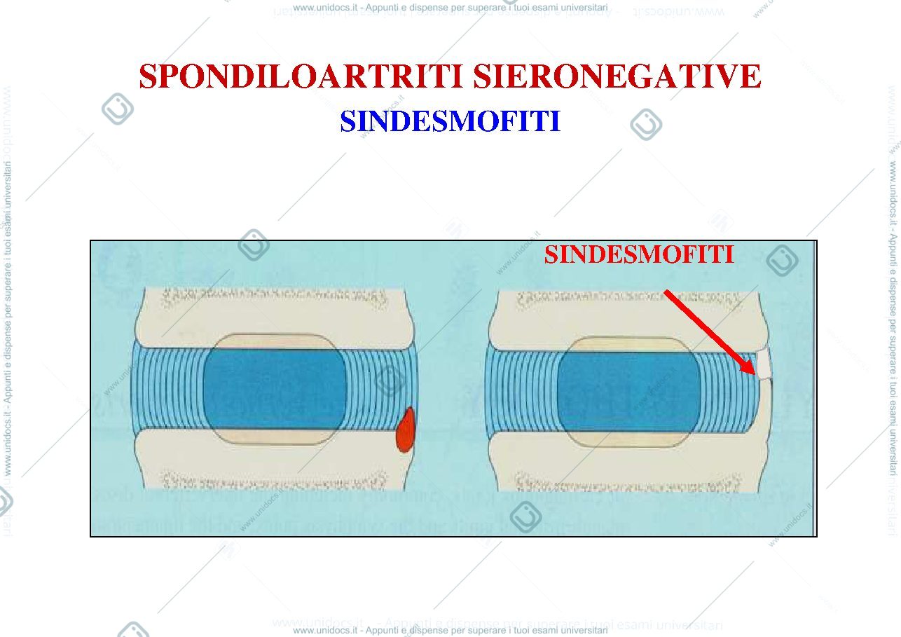 Anteprima pagina 3 — artrite reumatoide