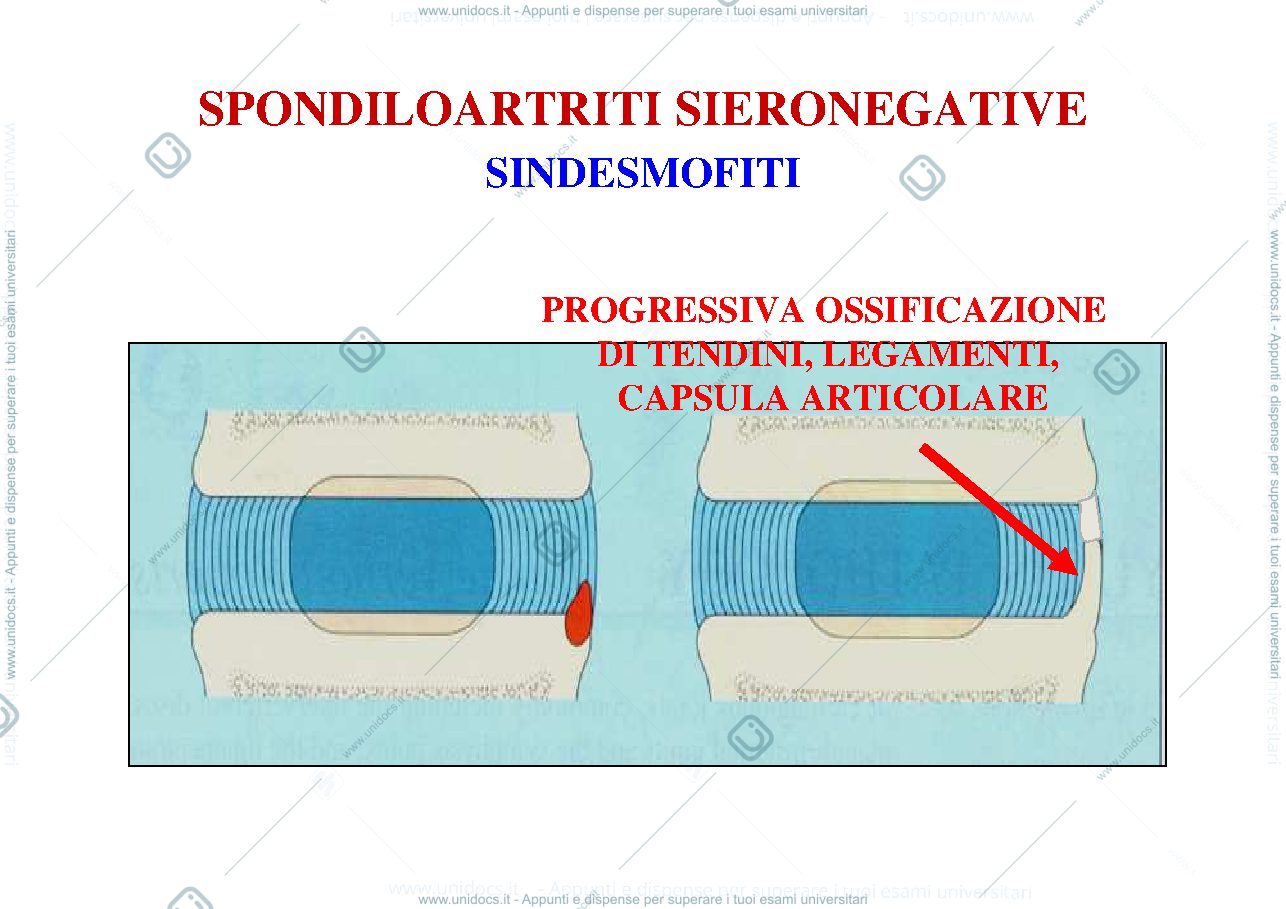 Anteprima pagina 4 — artrite reumatoide